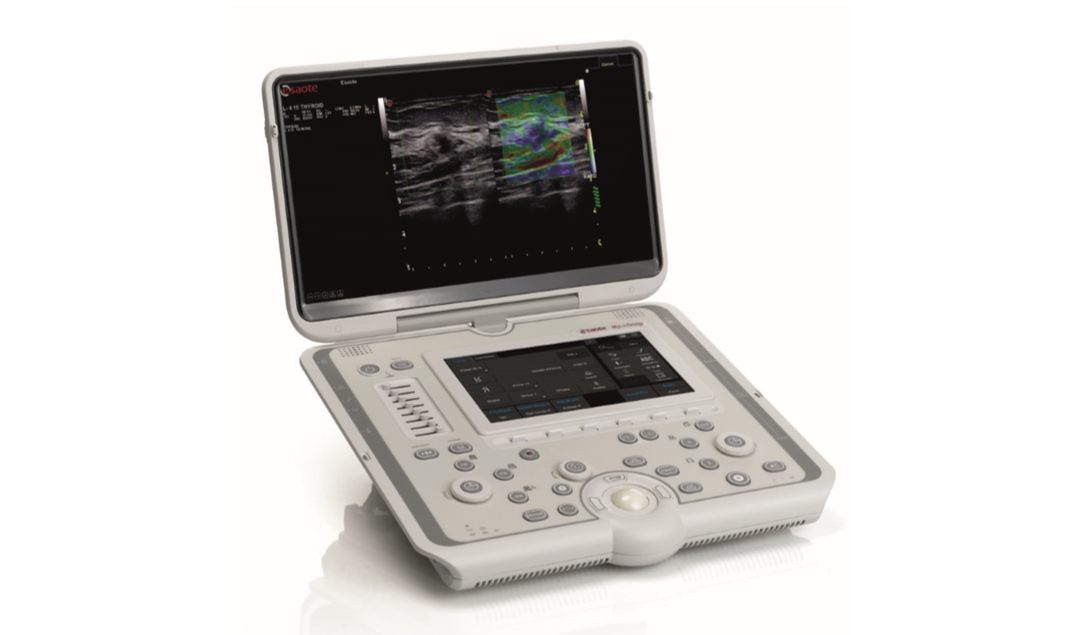 MyLab™Omega of Esaote portable ultrasound