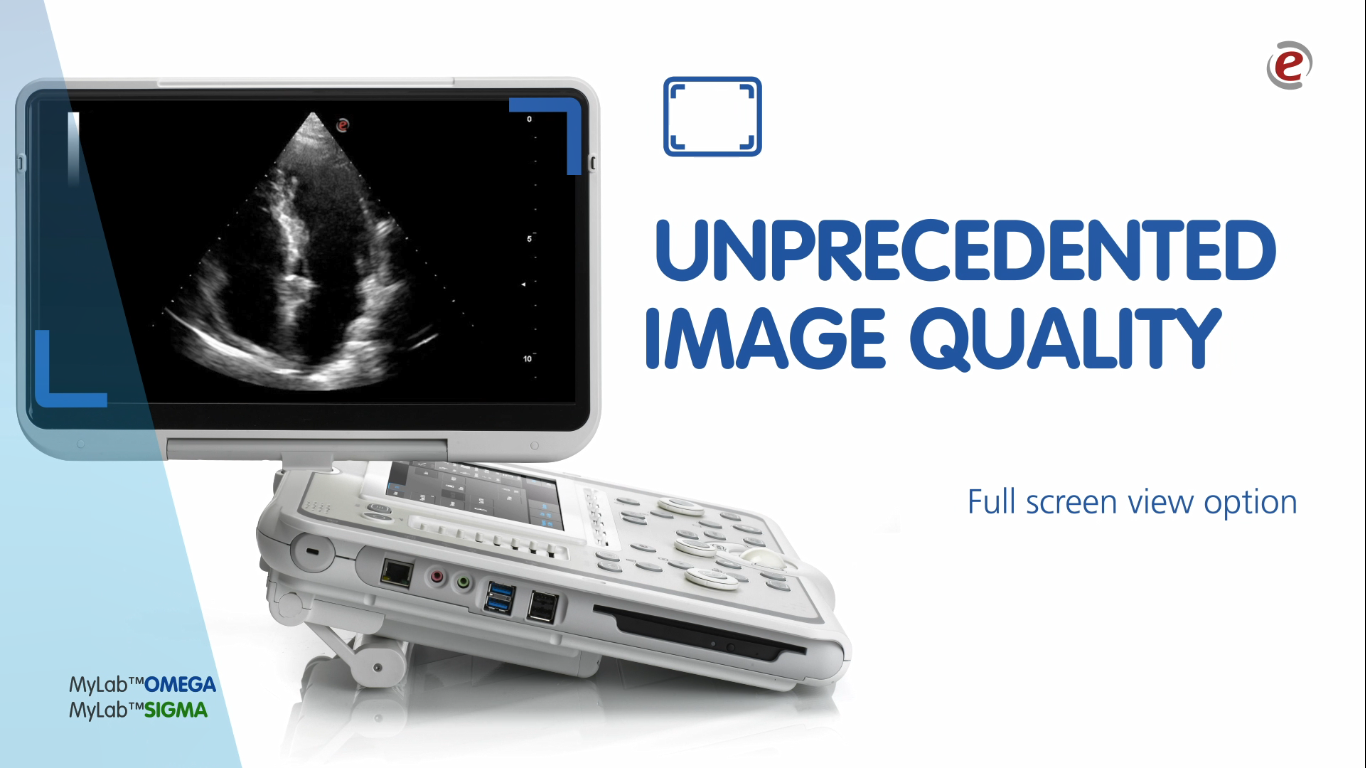 MyLab™Omega of Esaote portable ultrasound