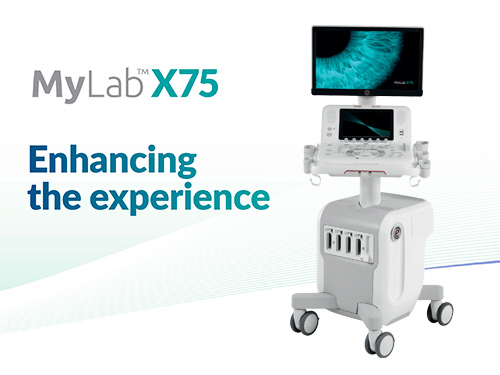 MyLab™X75 Esaote ultrasound