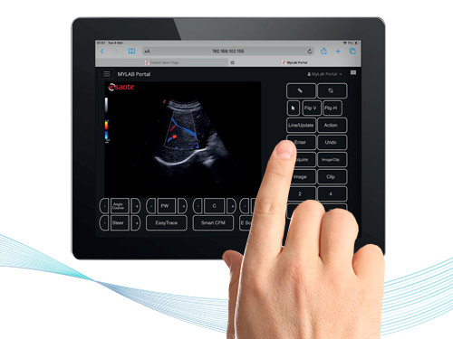 MyLab™X75 Esaote ultrasound